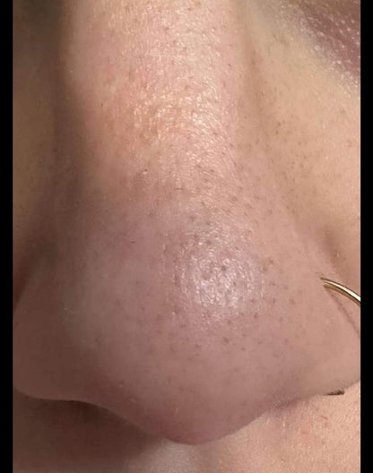 Connect-the-Dots Mask (blackheads)