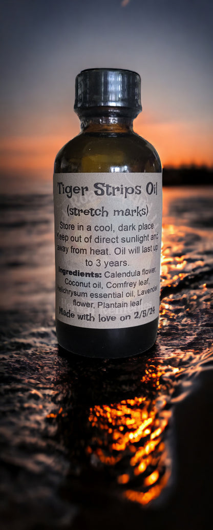 Tiger Stripes Oil (stretch marks)